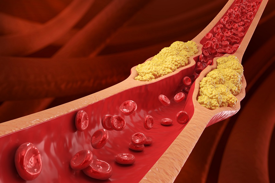 policosanol kan sænke kolesteroltallet